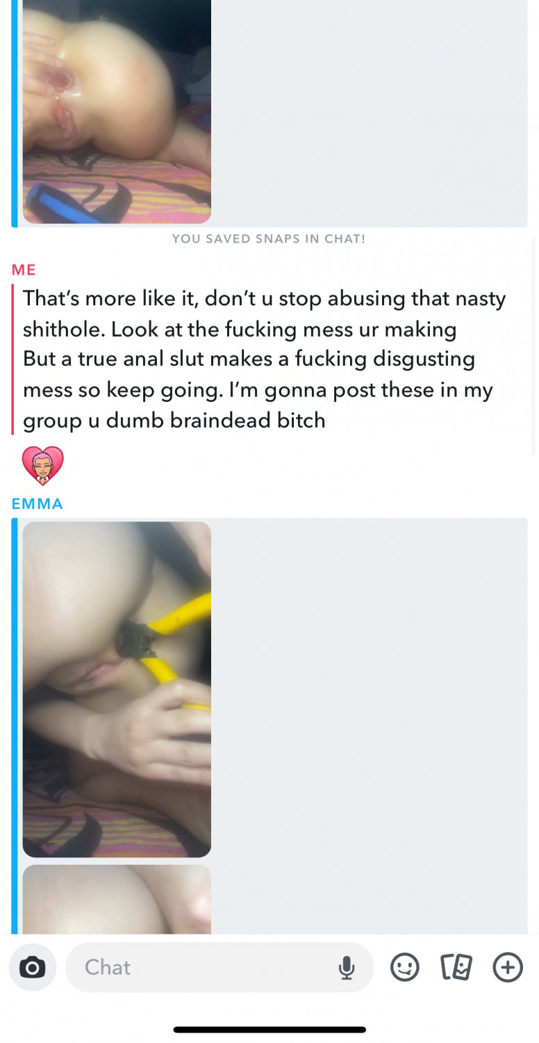 DUMBEST ANAL ONLY weblut on the planet 🌍😵‍💫. Schau dir an, was sie sich in den Hintern schiebt! 🤣 2