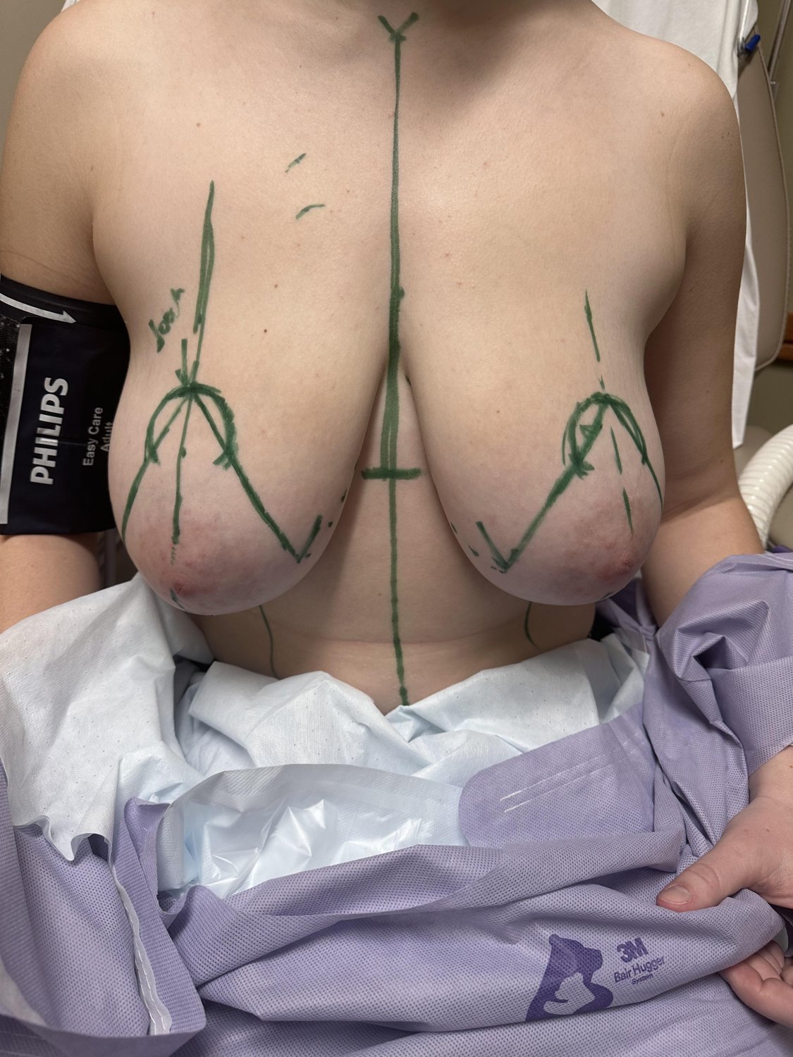Huge Titties After Reduction Still Look Amazing 12
