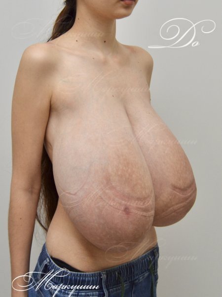 Huge Titties After Reduction Still Look Amazing 23