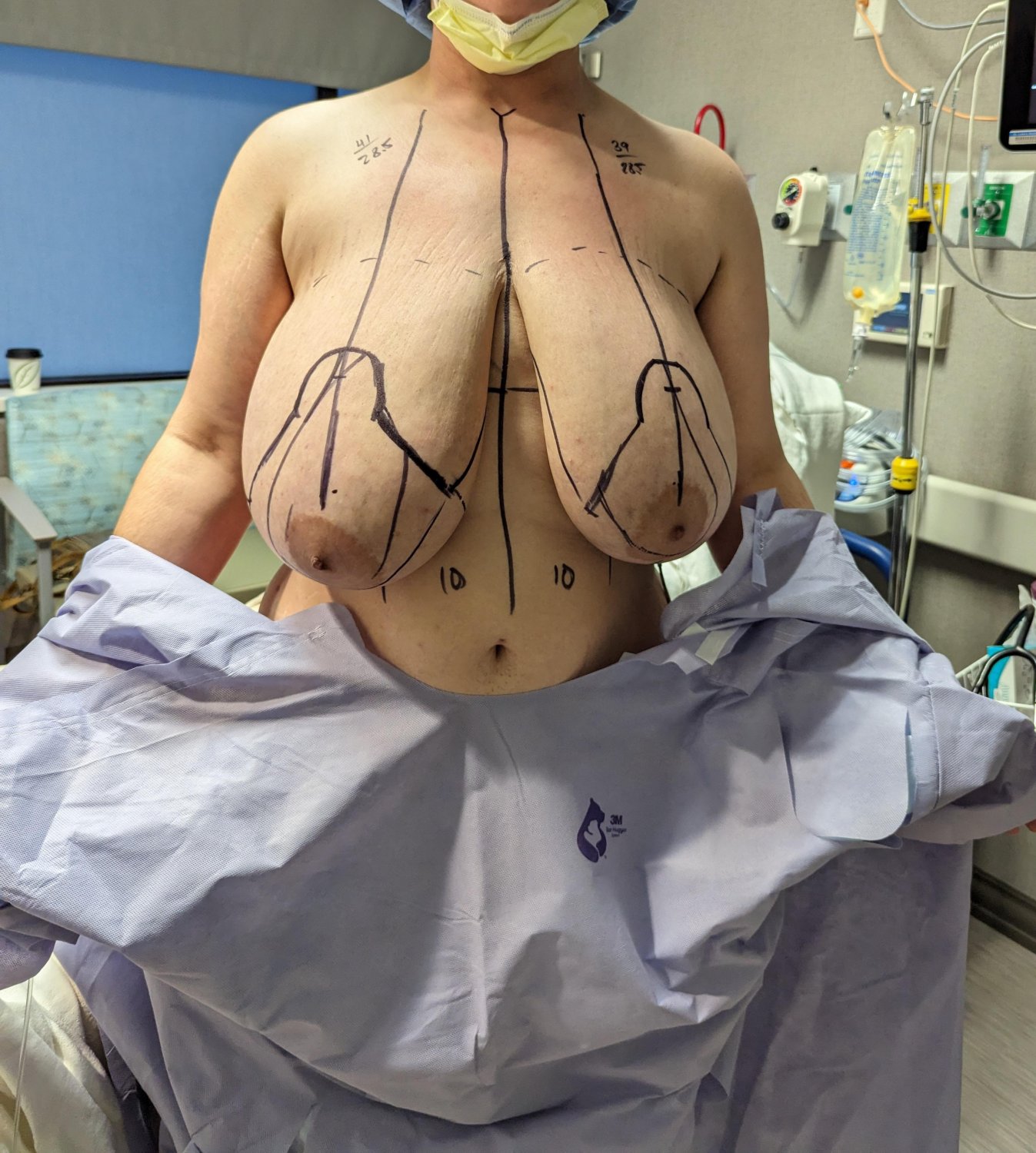 Huge Titties After Reduction Still Look Amazing 26