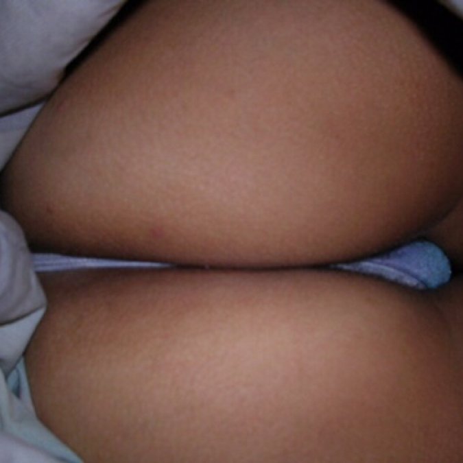 Ex gf 10