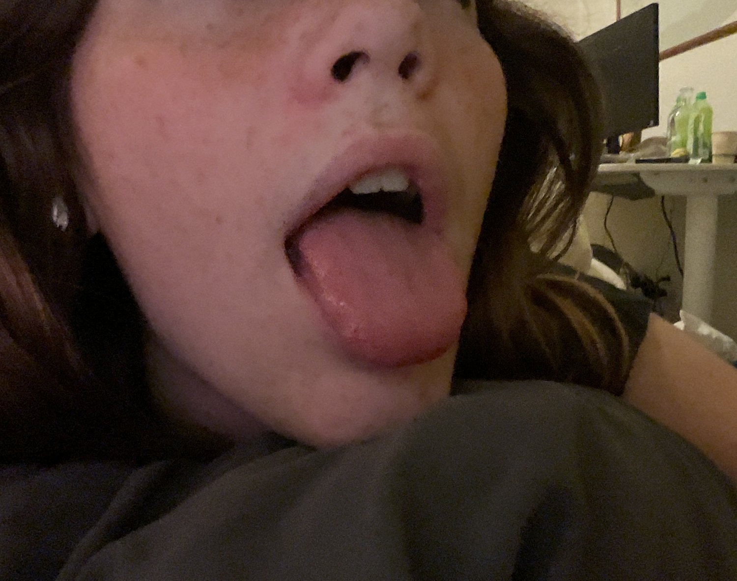 lentigginoso 4channer 1